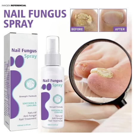 REPARADOR DE UÑAS "nail fungus spray"